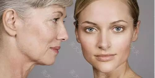 线雕和玻尿酸，总有一个适合你