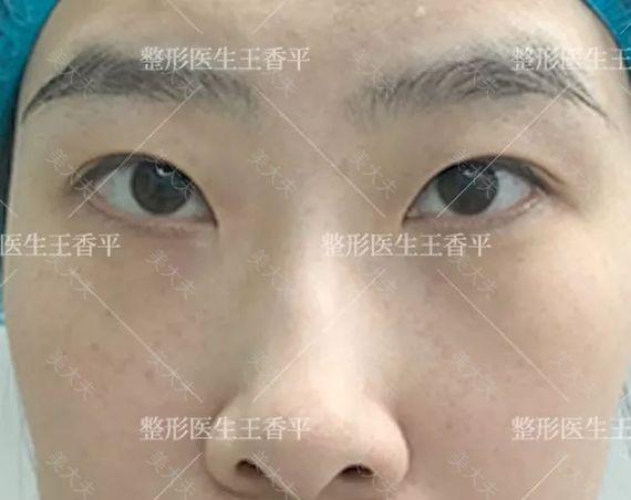 蓉.jpg