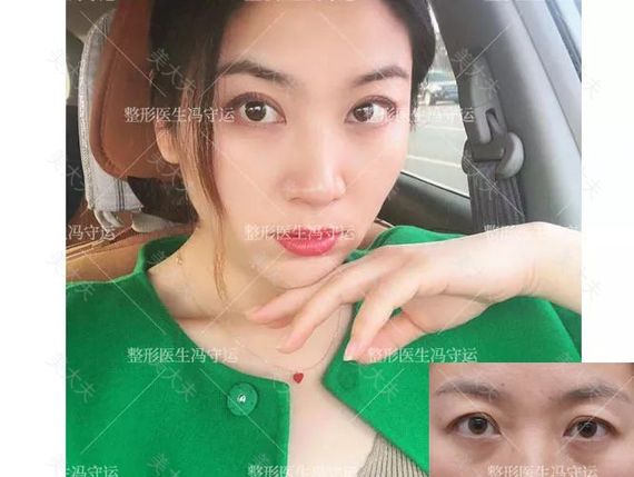 贾丽萌 修复 松弛.jpg