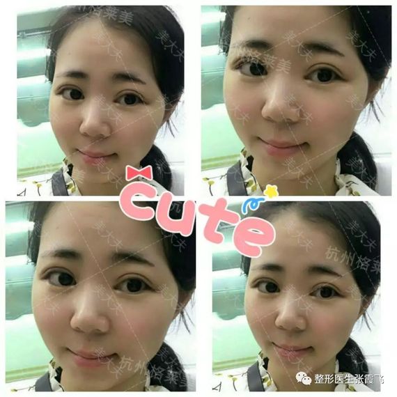 xmy_1504504558/2017-09-04-15-50-39-5154.jpg