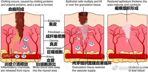 怎样消除普通疤痕？