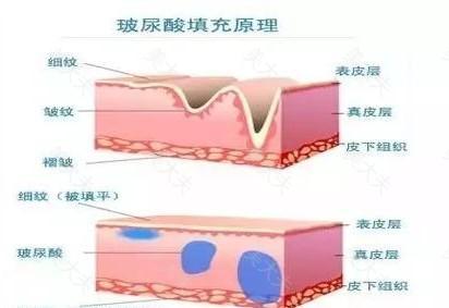 【手部保养放大招】和皱纹、干裂说再见,做手部spa不难