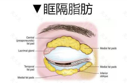 双眼皮