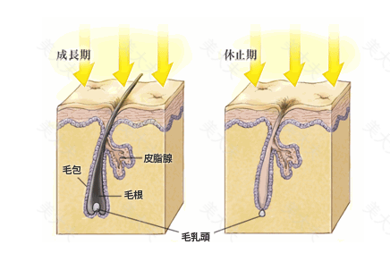 多毛症和毛发过多怎么治疗 全身脱毛 通拉嘎 美大夫