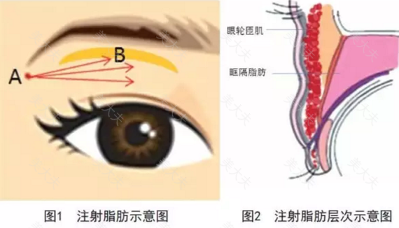 QQ截图20180831182342.png