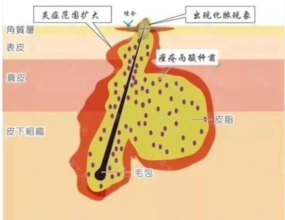 不要错过这个修复毛孔、黑头的好季节！错过要再等一年哦