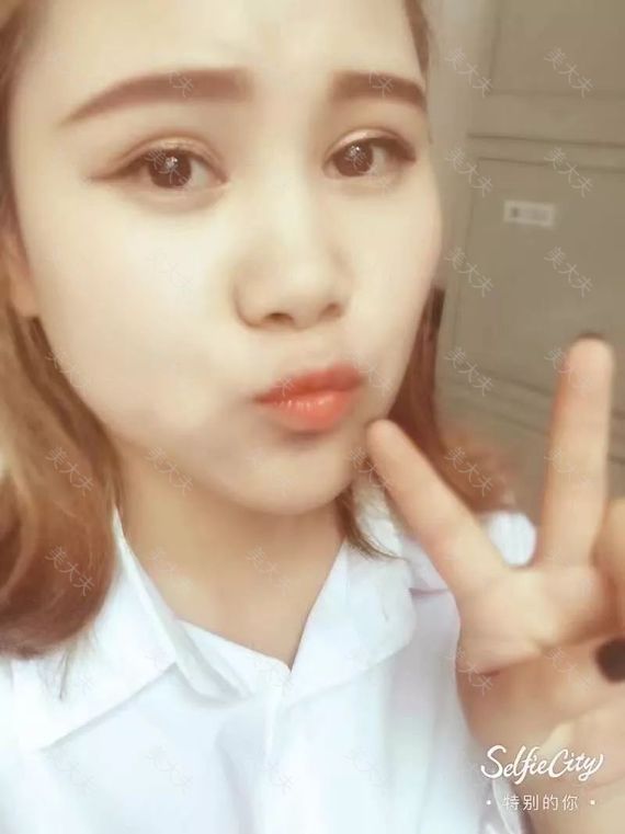 术后微信图片_20170822114015.jpg