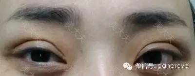 课堂案例丨修复9号：顾客的自述——十年黑暗终得云开见月明