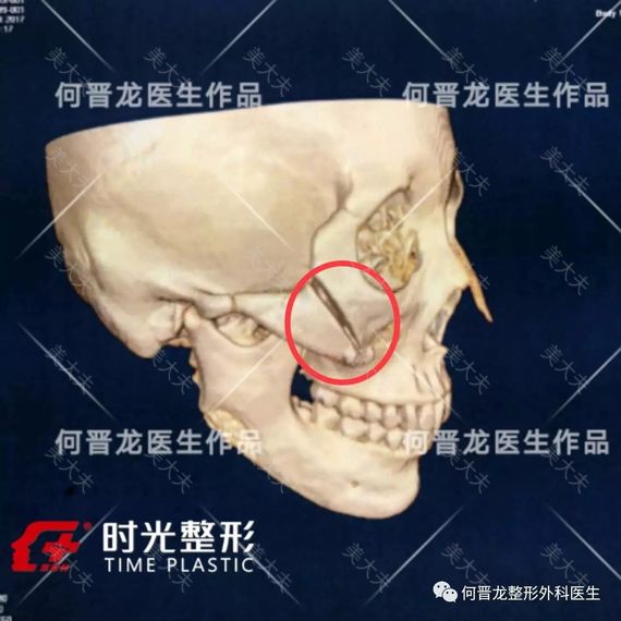 微信图片_20170825154421.jpg