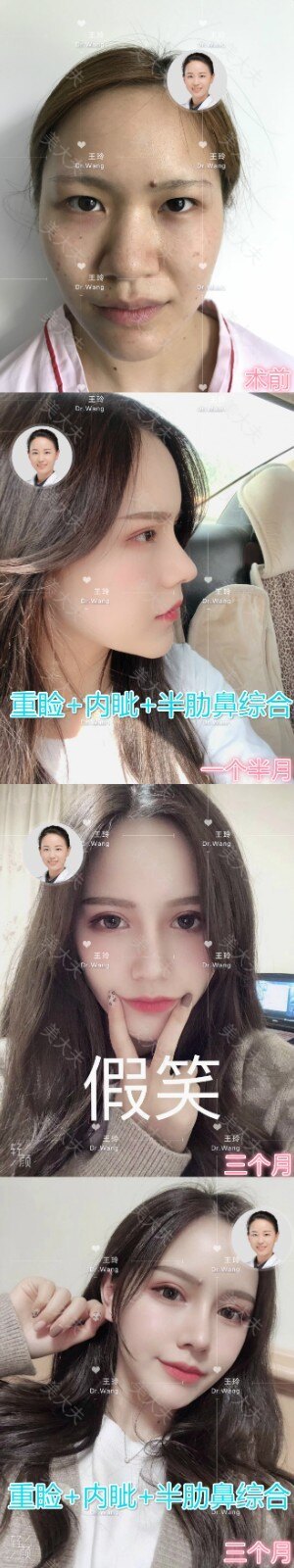 2e23c8fae804916cb6c1e8032f0a234_meitu_1.jpg