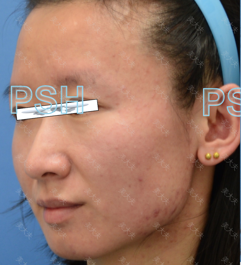 包含中国医学科学院整形外科医院核磁加急的词条 包含中国医学科学院整形外科医院核磁加急的词条