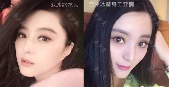 编辑区添加图片模板,点击图片区域可以更换图片。