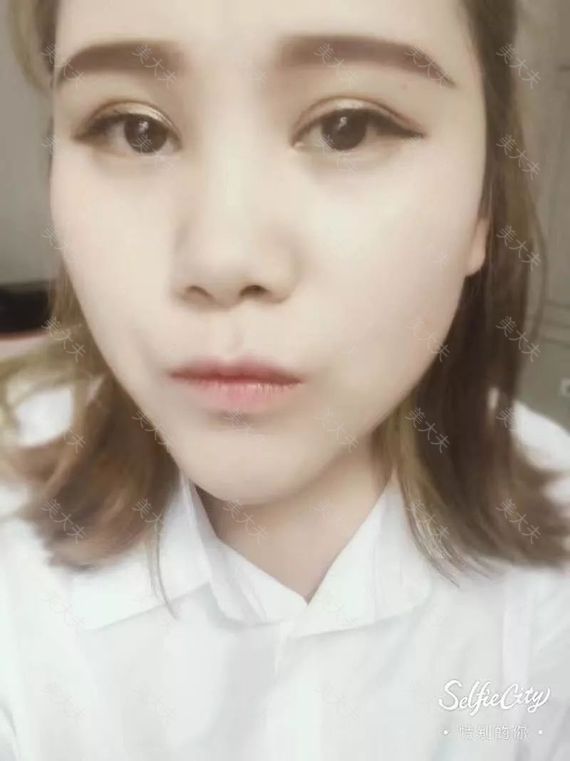 术后微信图片_20170822114020.jpg
