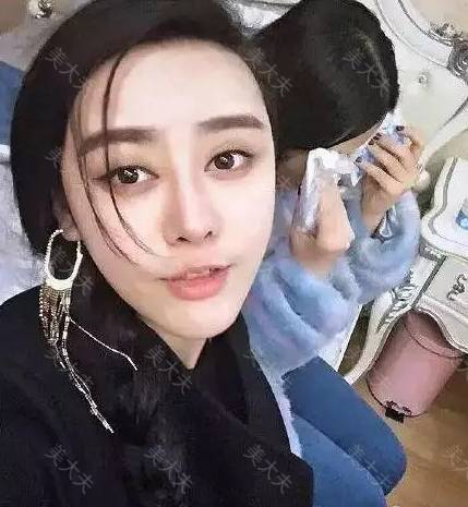 编辑区添加图片模板,点击图片区域可以更换图片。
