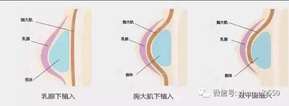 从我的图库中选择图片