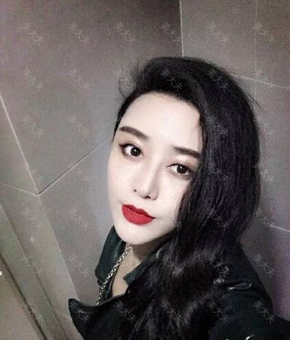 编辑区添加图片模板,点击图片区域可以更换图片。