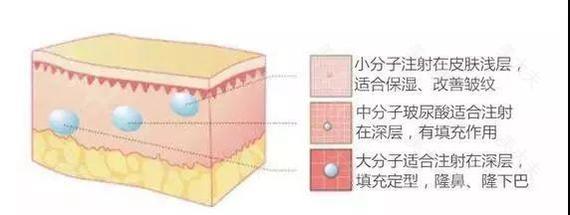 玻尿酸最强科普，你最关心的都在这，一次给你扯清楚