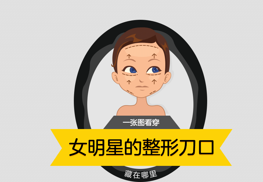 【转】一张图看穿明星整容刀口藏在哪！