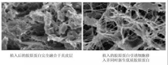 “肤色暗沉十余年，我是如何改善它的”