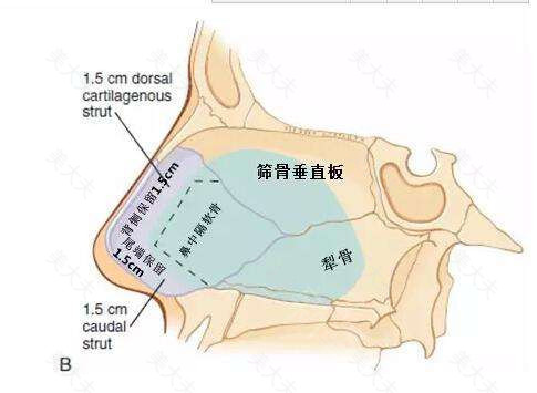 鼻小柱