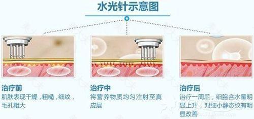 今天说说护肤里最有争议的话题