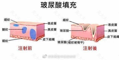 如何拥有少女颜？？？用TA就对啦