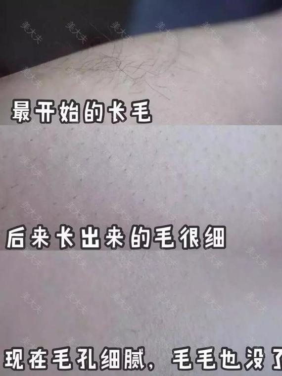 “闺蜜看见我脱毛，说我心机太重”