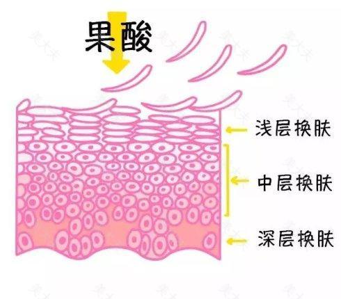 刷果酸有什么副作用？