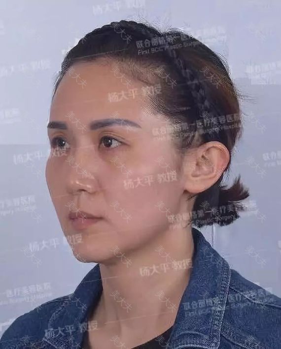 术前_meitu_1.jpg