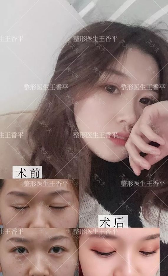 李君颜.jpg